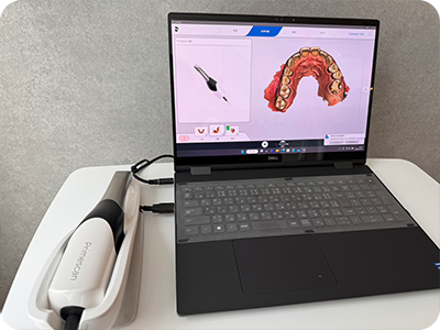 プライムスキャン